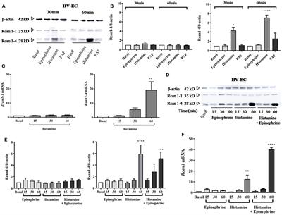 Endothelial Regulator of Calcineurin 1 Promotes Barrier Integrity and Modulates Histamine-Induced Barrier Dysfunction in Anaphylaxis